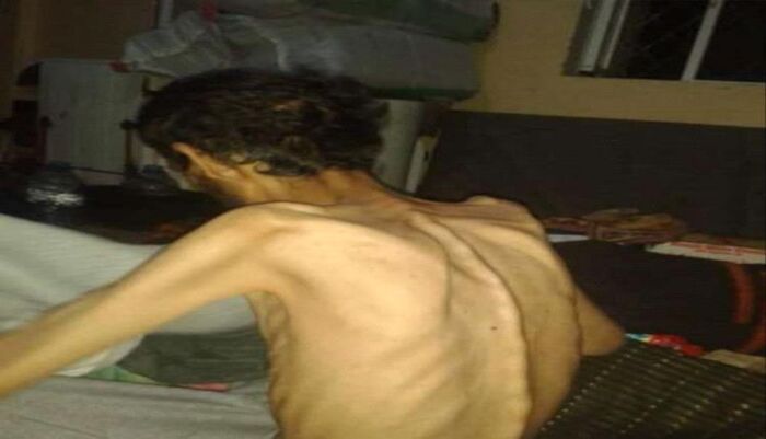 اسرار | بالارقام والتفاصيل.. تقرير صادم- بينهم نساء وأطفال.. تعرض أكثر من 1800 مختطف لأساليب تعذيب وحشية في سجون الحوثي