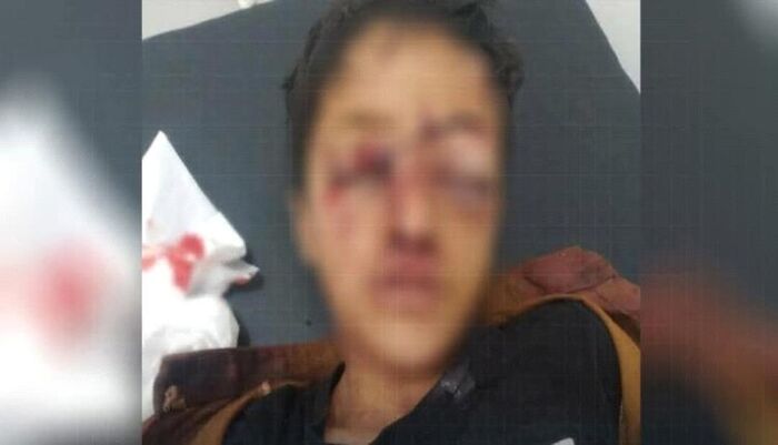 اسرار | مروعة..  الشرعية تكشف جريمة حوثية جديدة في اليمن وتفضح زيف شعارات نصرة غزة