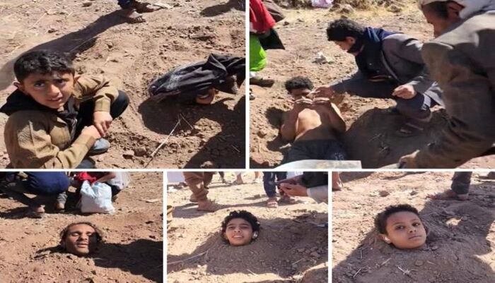 اسرار | الجهل - من وهم البركة إلى خطر الموت.. خرافات الحوثي تدفن مرضى الصرع أحياء في هذه المحافظة