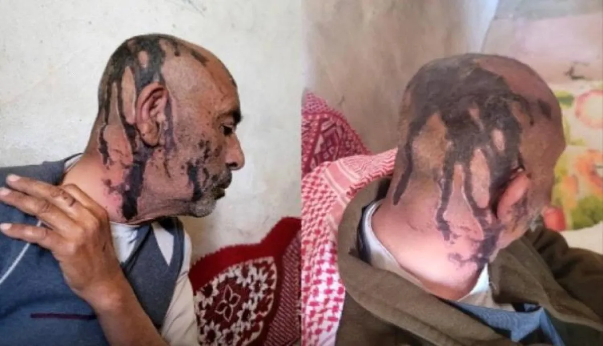 اسرار | بالصورة والتفاصيل .. مشهد صادم : أب يمني يتعرض للضرب المبرح من قبل أبنائه المنخرطين مع الحوثي | شاهد