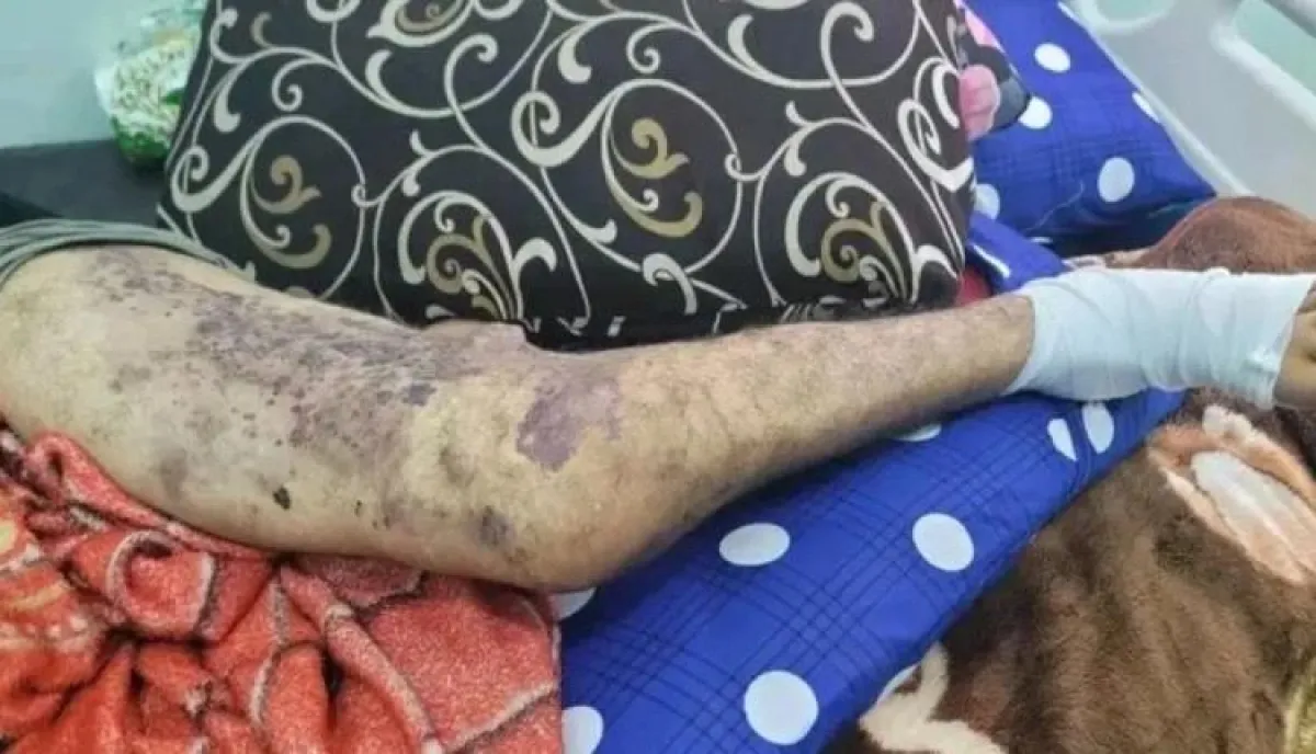 اسرار | بالاسماء والتفاصيل.. نداء استغاثة من سجين يعاني من مرض نادر في تعز: أفرجوا عني قبل فوات الأوان