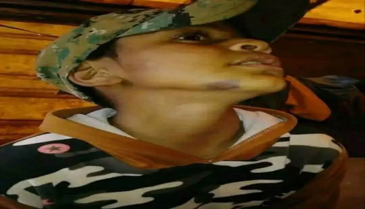 اسرار | بالاسماء والتفاصيل - اعتداء صادم في صنعاء.. مسلح يهاجم طفلا يتيما ثم يدهس والده أمام المارة