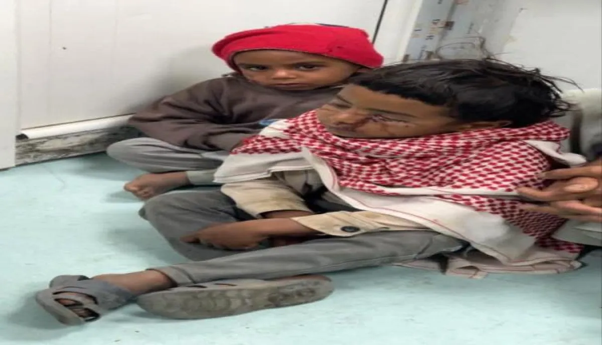 اسرار | بالاسماء والتفاصيل- هجوم كلاب ضالة في صنعاء يُصيب طفلين وتحذير طبي خطير