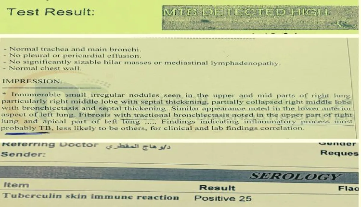 اسرار | بالاسماء والتفاصيل- طبيب في صنعاء يكشف وهم التيفود ويُعري خللاً خطيراً بالفحوصات الطبية