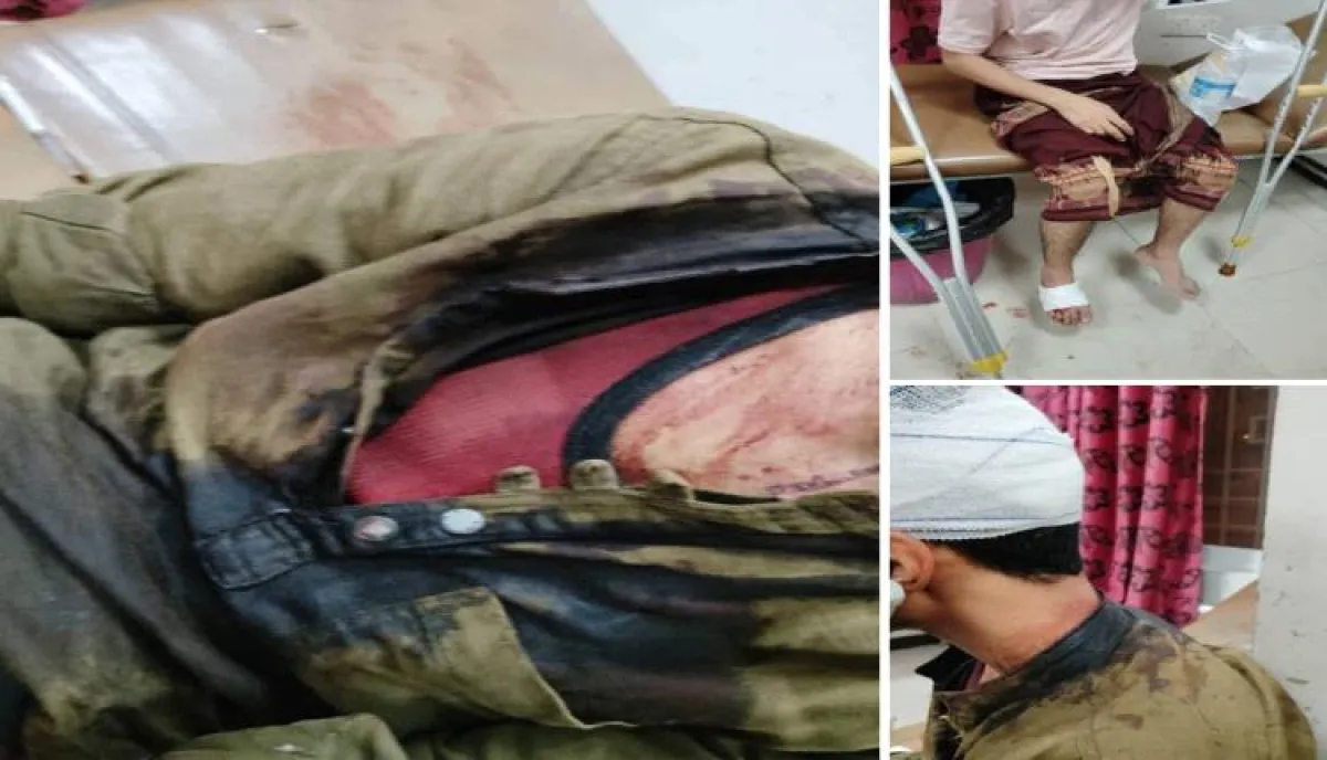 اسرار | بالتفاصيل- حادثة عنف مقلقة .. اعتداء جماعي دامي على طلاب من أبناء المخا في مدينة تعز