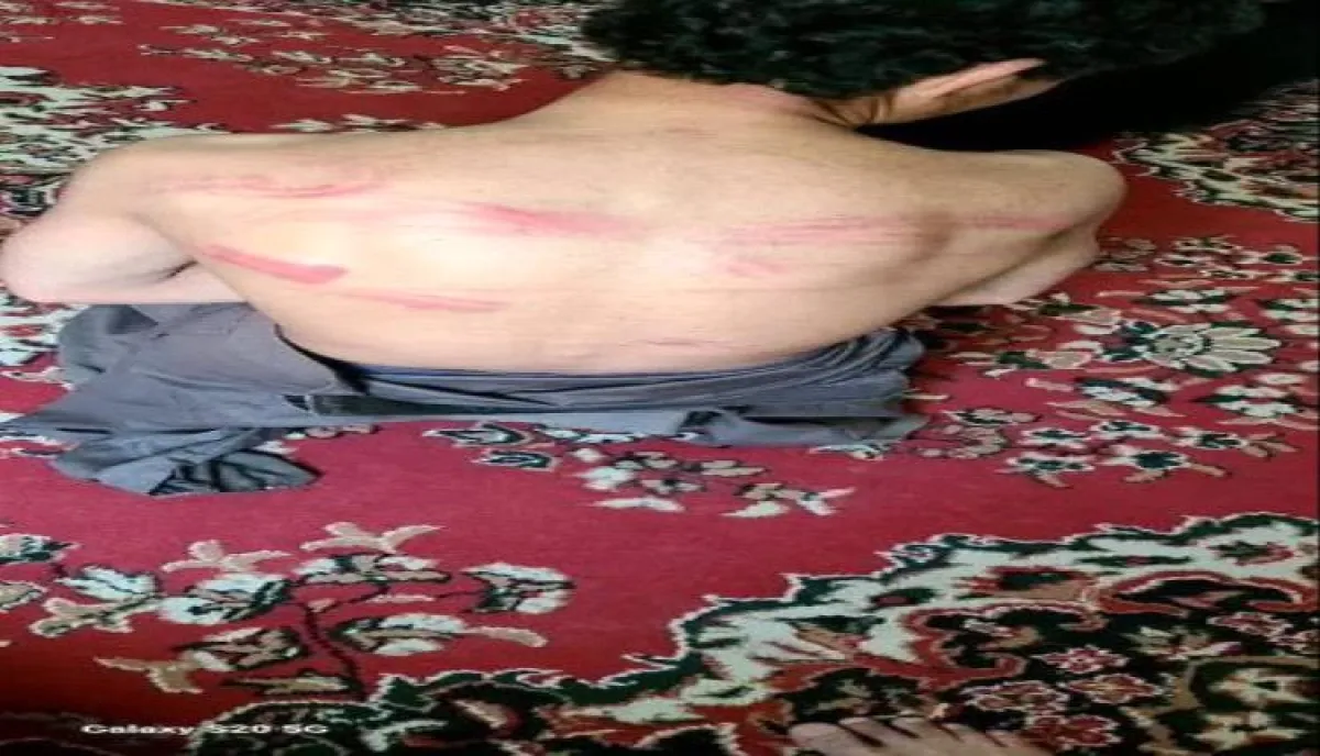 اسرار | بالصور  والاسماء ..قيادي حوثي يعذب طفل داخل سجن سري في صعدة | شاهد