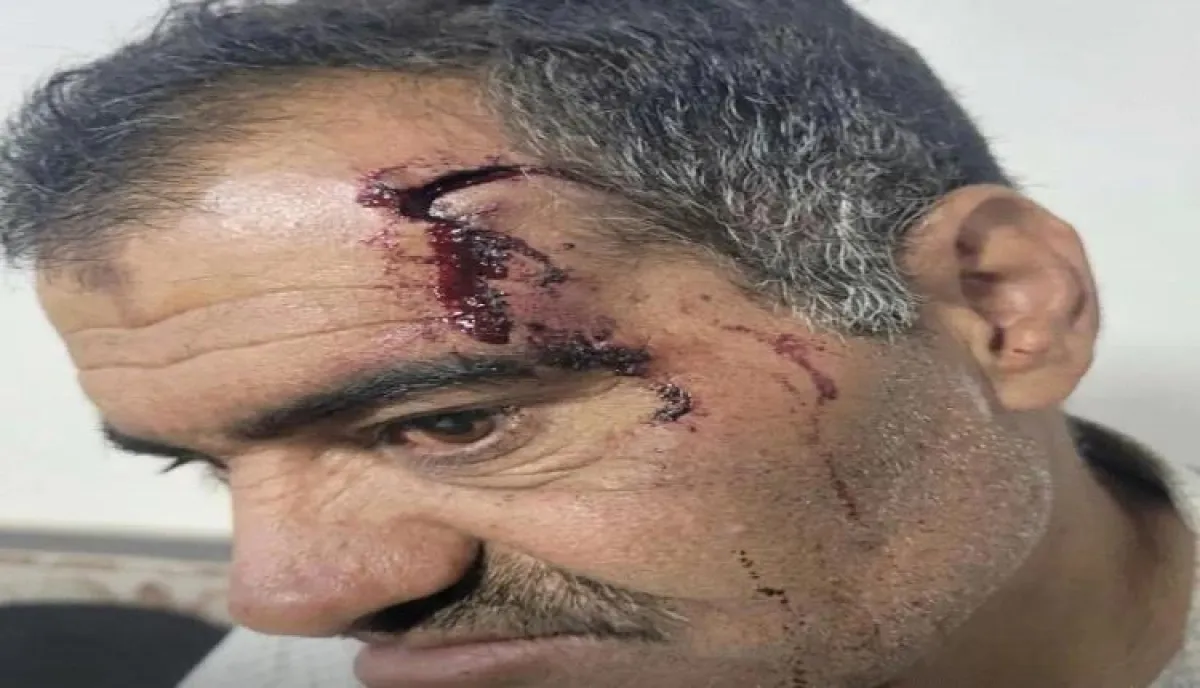 اسرار | بالاسماء والتفاصيل.. "غزوة الغربية" : سحلٌ وإهانة علنية.. "مافيا الجبايات" الحوثية تنكّل بعاقل حارة في ذمار بسبب "إتاوات الزكاة"