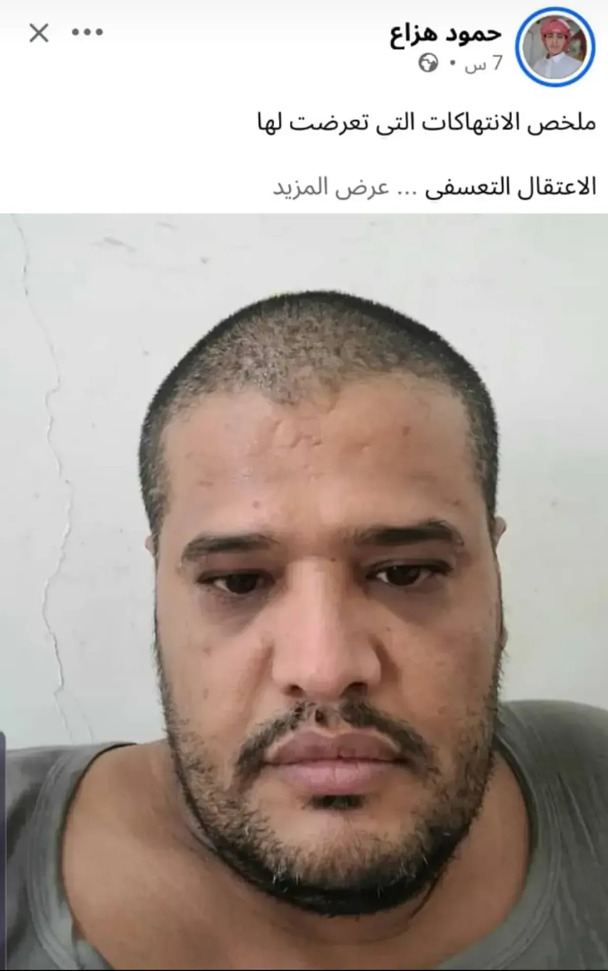 اسرار | بالاسماء والتفاصيل- تفتيش هاتف وحلق شعر وتشهير.. صحفي يكشف تفاصيل انتهاكات جسيمة تعرض لها في سجون الاصلاح بمأرب