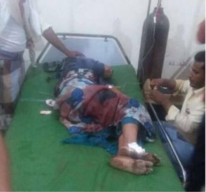 مقتل واصابة أطفال ونساء في قصف حوثي على مدينة حيس بالحديدة