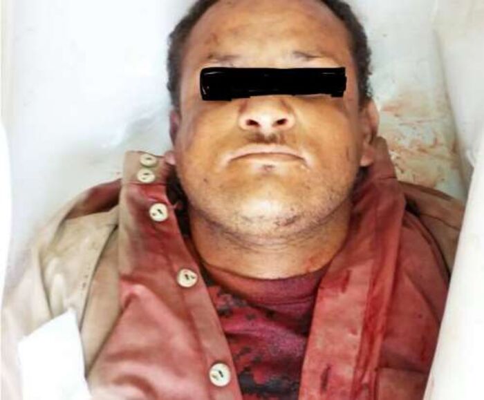 مقتل القيادي الحوثي الشهاري شمال حيس ومصرع ( المتوكل ) قائد جبهة الحوثيين في مقبنة