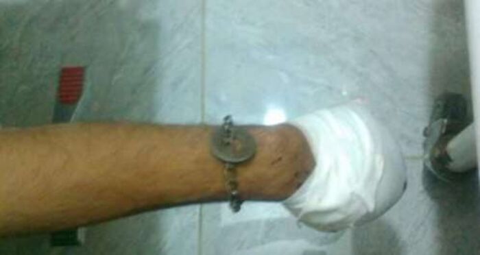 اسرار| مقاتلو الحوثي يستخدمون (حيلة) بطريقة مؤلمة للهرب من الحديدة