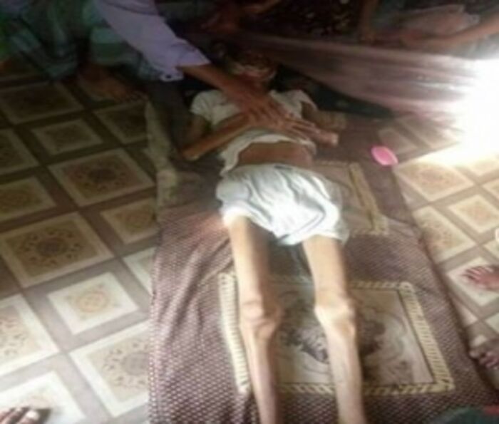 اسرار| شاهد ..تفاصيل مروعة بالصور.. هكذا عذب الحوثيين الصحفي أنور الركن حتى الموت