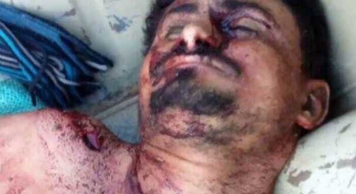 اسرار اليمن| القيادات الحوثية تتسول قبائل اليمن.. انهيارات كبيرة في صفوف الجماعة